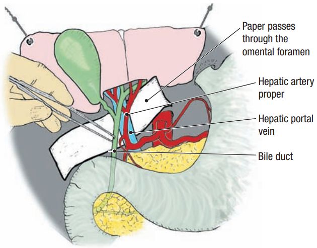 肝脏门脉三合体 - 嘉应学院医学院解剖教研室