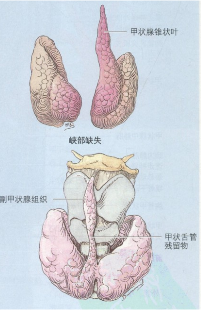 通常,锥状叶自甲状腺峡部向上延伸,常位于中线的左侧.
