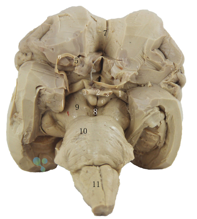 脑干腹侧面图片
