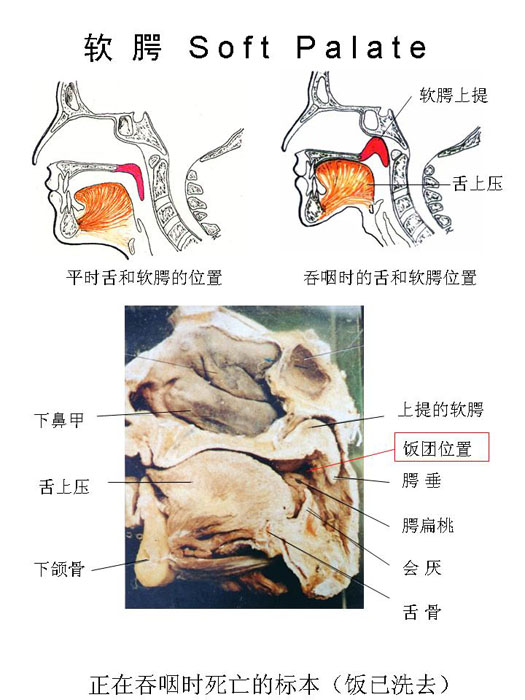 软腭黏膜组织结构图图片