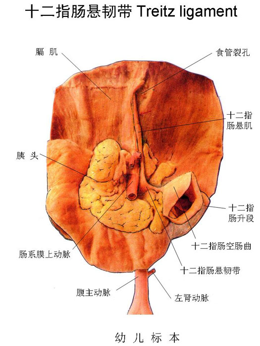十二指肠悬韧带的位置图片