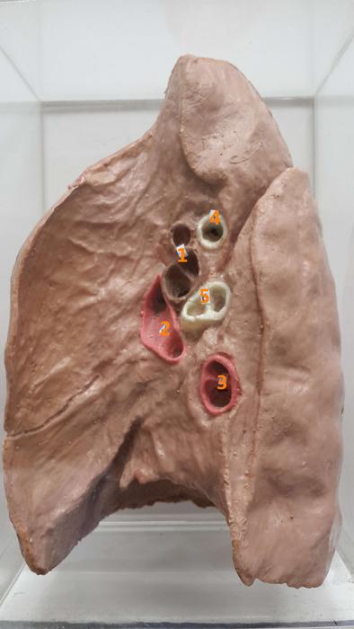 呼吸系统-右肺内面观