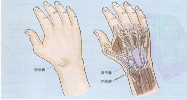 肱动脉高位分支