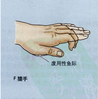 拇指对掌运动示意图图片
