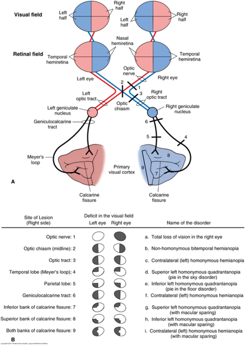 ii视神经 - 嘉应学院医学院解剖教研室