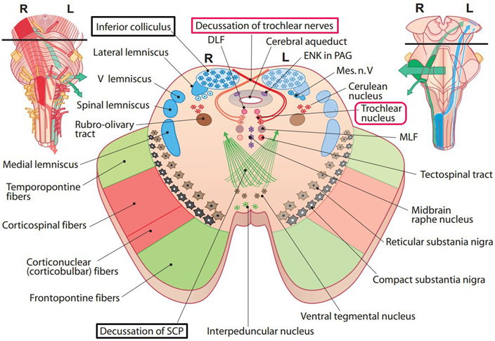 动眼神经 滑车神经 展神经