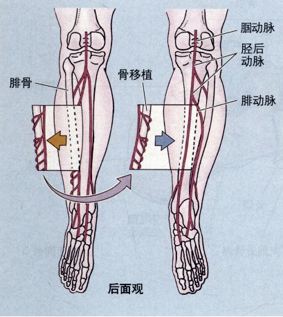 下肢(一) - 嘉應學院醫學院解剖教研室